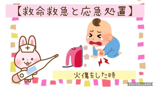◆やけどをしたとき